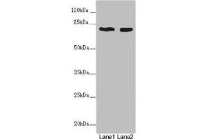 Western blot All lanes: UVRAG antibody at 2 μg/mL Lane 1: SH-SY5Y whole cell lysate Lane 2: 293T whole cell lysate Secondary Goat polyclonal to rabbit IgG at 1/10000 dilution Predicted band size: 79, 36 kDa Observed band size: 79 kDa (UVRAG Antikörper  (AA 375-425))