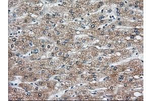 Immunohistochemical staining of paraffin-embedded Human liver tissue using anti-KHK mouse monoclonal antibody. (Ketohexokinase Antikörper)
