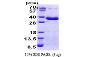 Family with Sequence Similarity 84, Member A (FAM84A) (AA 1-292) protein (His tag)