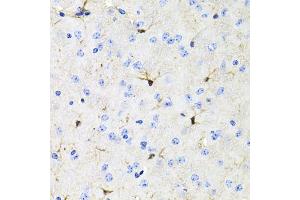 Immunohistochemistry of paraffin-embedded mouse brain using ACVR2A antibody (ABIN5971030) at dilution of 1/100 (40x lens). (ACVR2A Antikörper)