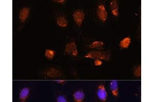 Immunofluorescence analysis of U-2 OS cells using RPL34 Polyclonal Antibody at dilution of 1:100. (RPL34 Antikörper)