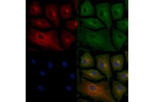 ABIN6258567 and ABIN6276236 staining  cells by IF/ICC. (VN1R2 Antikörper  (Internal Region))