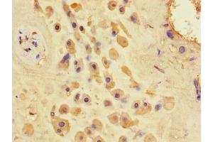 Immunohistochemistry of paraffin-embedded human placenta tissue using ABIN7154826 at dilution of 1:100 (TSC1 Antikörper  (AA 101-344))