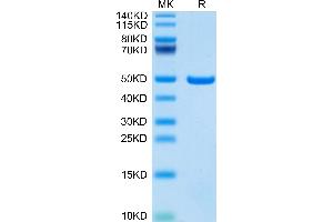 Aspartate beta Hydroxylase Protein (AA 324-741) (His tag)