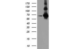 HEK293T cells were transfected with the pCMV6-ENTRY control (Left lane) or pCMV6-ENTRY ZIM2 (Right lane) cDNA for 48 hrs and lysed. (ZIM2 Antikörper  (AA 1-150, AA 428-527))