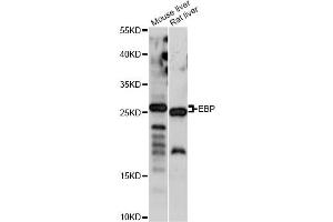Western blot analysis of extracts of various cell lines, using EBP antibody (ABIN6290781) at 1:1000 dilution. (EBP Antikörper)