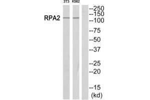 Western blot analysis of extracts from Jurkat/NIH-3T3 cells, using POLR1B antibody. (POLR1B Antikörper  (C-Term))