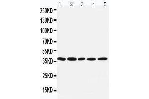 Anti-IRF1 antibody, Western blotting Lane 1: COLO320 Cell Lysate Lane 2: U87 Cell Lysate Lane 3: HELA Cell Lysate Lane 4: JURKAT Cell Lysate Lane 5: MCF-7 Cell Lysate (IRF1 Antikörper  (Middle Region))