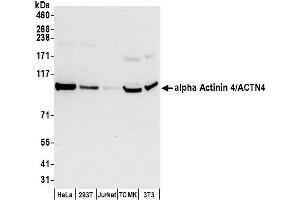 Western Blotting (WB) image for anti-Actinin, alpha 4 (ACTN4) (AA 1-50) antibody (ABIN7449956)