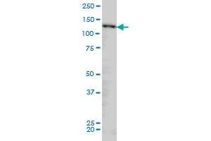 NUP133 monoclonal antibody (M01), clone 3E8 Western Blot analysis of NUP133 expression in HeLa .