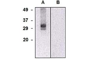 Western blotting analysis of CLIC5a in HEK293-CLIC5a transfectants (A) and (CLIC5 Antikörper  (AA 160-173))