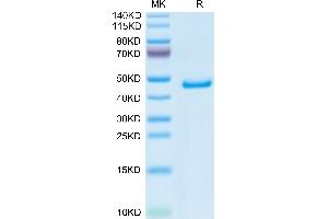 Mouse GP1BB on Tris-Bis PAGE under reduced condition. (GP1BB Protein (AA 27-147) (Fc Tag))