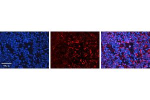 Immunohistochemistry (IHC) image for anti-phospholipase C, gamma 1 (PLCG1) (C-Term) antibody (ABIN5517384)