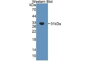 Detection of Recombinant Agrin, Human using Polyclonal Antibody to Agrin (AGRN) (AGRN Antikörper  (AA 1329-1548))