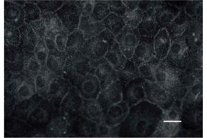 Immunocytochemistry (ICC) image for anti-Natriuretic Peptide Receptor A/guanylate Cyclase A (Atrionatriuretic Peptide Receptor A) (NPR1) (AA 294-308) antibody (ABIN109966)