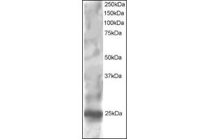 Antibody staining (1 µg/ml) of HepG2 lysate (RIPA buffer, 30 µg total protein per lane). (RGS1 Antikörper  (C-Term))