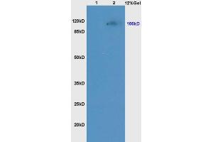 Lane 1: mouse kidney lysates Lane 2: mouse liver lysates probed with Anti NCX1/SLC8A1 Polyclonal Antibody, Unconjugated (ABIN731198) at 1:200 in 4 °C. (SLC8A1 Antikörper  (AA 801-900))