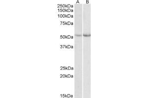 AP21507PU-N Phe Hydoxylase antibody staining of Mouse (A)  and Rat (B) Liver lysate at 0. (Phenylalanine Hydroxylase Antikörper  (Internal Region))