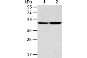 Gel: 8 % SDS-PAGE, Lysate: 40 μg, Lane 1-2: A172 and 293T cell, Primary antibody: ABIN7131322(TEKT4 Antibody) at dilution 1/200 dilution, Secondary antibody: Goat anti rabbit IgG at 1/8000 dilution, Exposure time: 1 minute (Tektin 4 Antikörper)