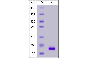IL-21 Protein (AA 30-162)