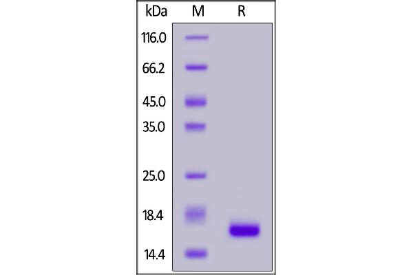 IL-21 Protein (AA 30-162)