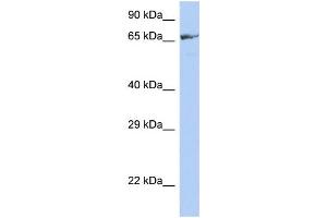 WB Suggested Anti-ZNF676 Antibody Titration:  0. (ZNF676 Antikörper  (Middle Region))