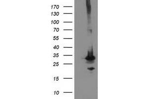 Image no. 4 for anti-Phenylethanolamine N-Methyltransferase (PNMT) antibody (ABIN1500307) (PNMT Antikörper)