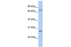 WB Suggested Anti-RCHY1 Antibody Titration:  0. (RCHY1 Antikörper  (N-Term))