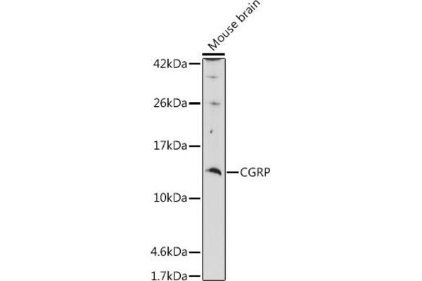 CGRP Antikörper  (AA 1-141)