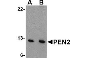 Western Blotting (WB) image for anti-Presenilin Enhancer 2 Homolog (PSENEN) (N-Term) antibody (ABIN1031508) (PEN2 Antikörper  (N-Term))