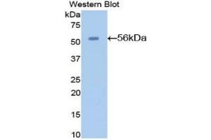 Western blot analysis of the recombinant protein. (AGT Antikörper  (AA 23-477))