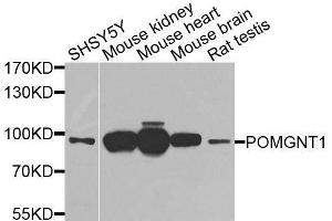 Western blot analysis of extracts of various cell lines, using POMGNT1 antibody. (POMGNT1 Antikörper  (AA 411-660))