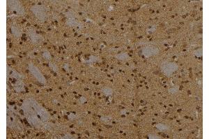 ABIN6257084 and ABIN6273565 at 1/100 staining Rat brain tissue by IHC-P. (CPXCR1 Antikörper  (N-Term))
