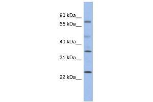 PPM1K antibody used at 1 ug/ml to detect target protein. (PPM1K Antikörper)
