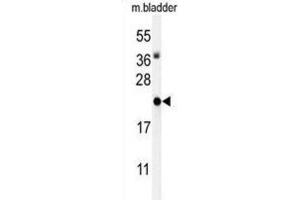 Western Blotting (WB) image for anti-Inhibitor of DNA Binding 4, Dominant Negative Helix-Loop-Helix Protein (ID4) antibody (ABIN3004406) (ID4 Antikörper)