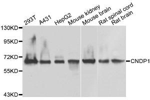 Western blot analysis of extracts of various cell lines, using CNDP1 antibody. (CNDP1 Antikörper)