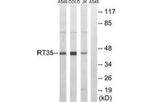 Western Blotting (WB) image for anti-Mitochondrial Ribosomal Protein S35 (MRPS35) (AA 211-260) antibody (ABIN2890043) (MRPS35 Antikörper  (AA 211-260))