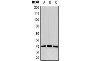 Western blot analysis of CD32b (pY292) expression in MCF7 pervanadate-treated (A), mouse liver (B), PC12 pervanadate-treated (C) whole cell lysates. (FCGR2B Antikörper  (C-Term, pTyr292))