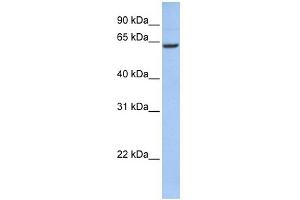 WB Suggested Anti-CCDC67 Antibody Titration: 0. (CCDC67 Antikörper  (N-Term))
