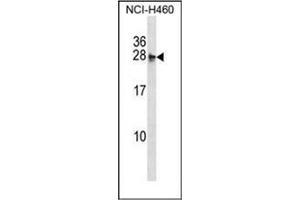 Western blot analysis of MOCS2 Antibody (N-term) in NCI-H460 cell line lysates (35ug/lane). (MOCS2 Antikörper  (N-Term))