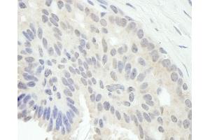Immunohistochemistry (IHC) image for anti-E2F Transcription Factor 1 (E2F1) (AA 300-350) antibody (ABIN7448537)