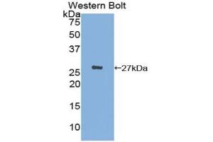 Western blot analysis of the recombinant protein. (CX3CL1 Antikörper  (AA 83-330))