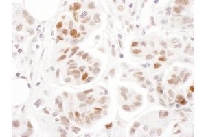 Immunohistochemistry (IHC) image for anti-Structural Maintenance of Chromosomes 1A (SMC1A) (pSer957) antibody (ABIN7453448)