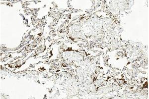 Immunohistochemical analysis of paraffin-embedded Human lung section using Pink1 am1851b. (LAMP2 Antikörper)
