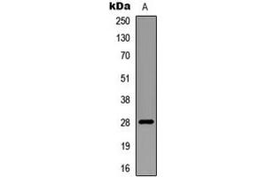 Western blot analysis of RNF138 expression in mouse multiple (A) whole cell lysates. (RNF138 Antikörper  (Center))