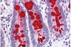 Immunohistochemistry (Formalin-fixed Paraffin-embedded Sections) (IHC (fp)) image for anti-Solute Carrier Family 9, Subfamily A (NHE3, Cation Proton Antiporter 3), Member 3 Regulator 1 (SLC9A3R1) (AA 252-359) antibody (ABIN790638)