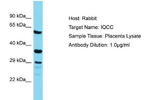 Host: Rabbit Target Name: IQCC Sample Tissue: Human Placenta Antibody Dilution: 1ug/ml