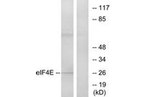 Western blot analysis of extracts from NIH-3T3 cells, treated with FBS, using eIF4E (Ab-209) Antibody. (EIF4E Antikörper  (AA 168-217))