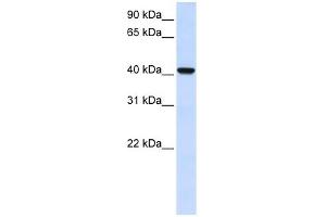 DGAT2L4 antibody used at 1 ug/ml to detect target protein. (AWAT2 Antikörper  (C-Term))