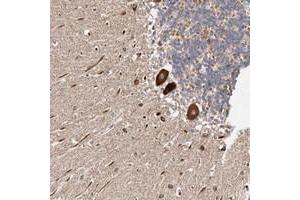 Immunohistochemical staining of human cerebellum with LUZP1 polyclonal antibody  shows strong cytoplasmic positivity in Purkinje cells at 1:10-1:20 dilution. (LUZP1 Antikörper)
